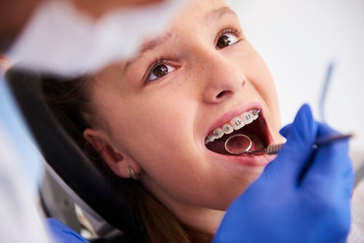 Understanding the Importance of Braces in Orthodontic Treatment