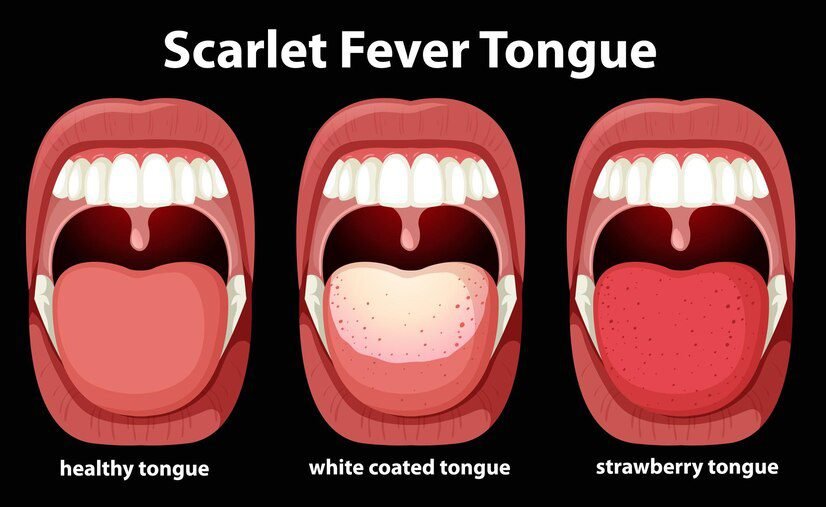 Possible Tongue Conditions and Their Meanings