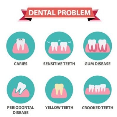Common Dental Issues Explained