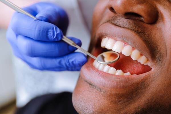 Importance of Finding the Right Dentist for Your Oral Health