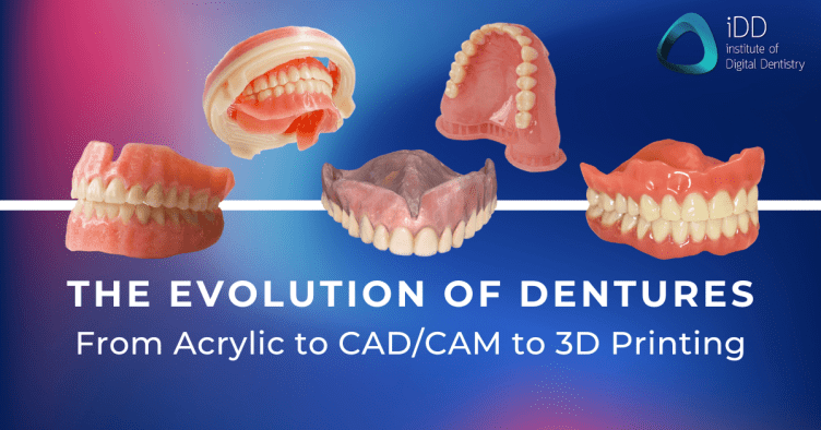 The Evolution of Dentures: From Traditional to Digital
