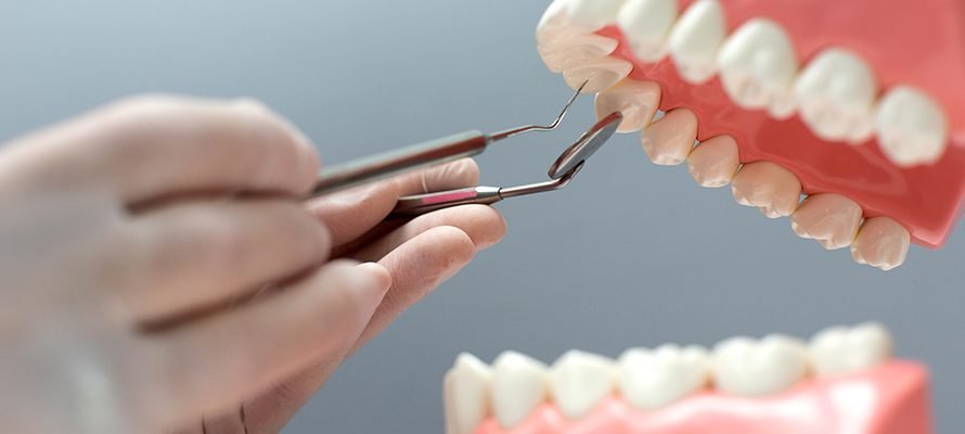 Understanding Dental Implants: A Permanent Solution for Missing Teeth