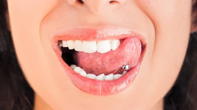 Oral Piercing Infections: Recognizing the Signs and Symptoms