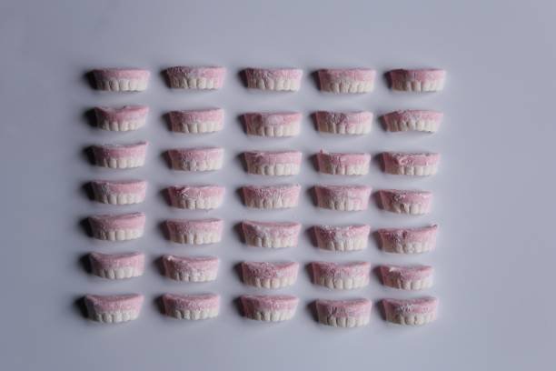 Identifying the Different Types of Dentures