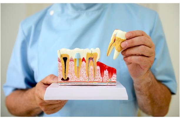 Understanding Dental Injuries: Types and Causes