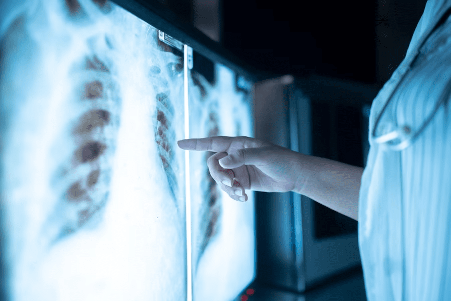 Digital Radiography: Advanced Imaging for Accurate Dental Diagnosis