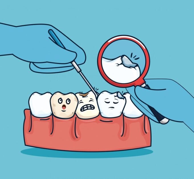The Role of Oral Hygiene in Preventing Cavities
