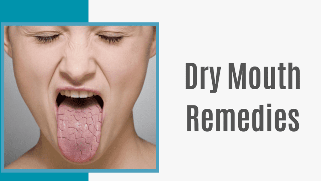 Dry Mouth What Causes It And How To Treat It 3065