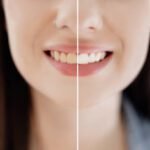 5 Simple Tips to Boost Your Dental Hygiene Routine