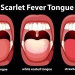 Possible Tongue Conditions and Their Meanings