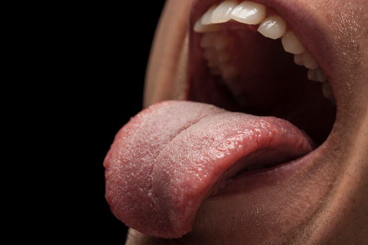 How Tongue Texture Can Indicate Health Issues