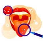 What’s in Your Mouth? The Surprising Microbiome of Your Oral Cavity