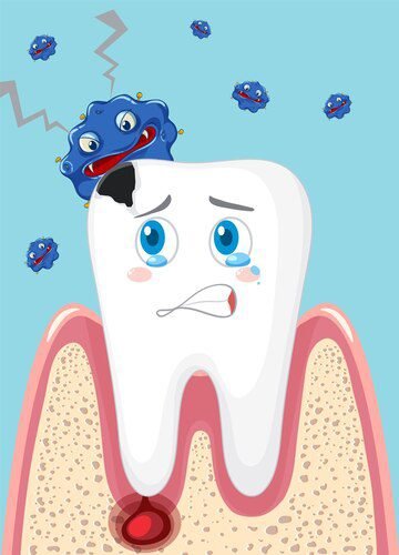 The Oral Microbiome and Dental Decay