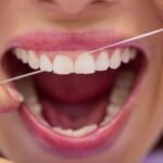 Flossing That Plaque Away: Techniques for Effective Flossing