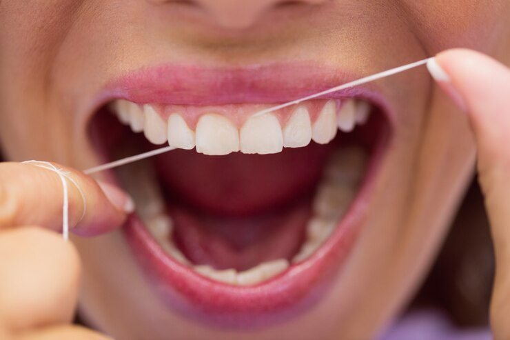 Flossing That Plaque Away: Techniques for Effective Flossing