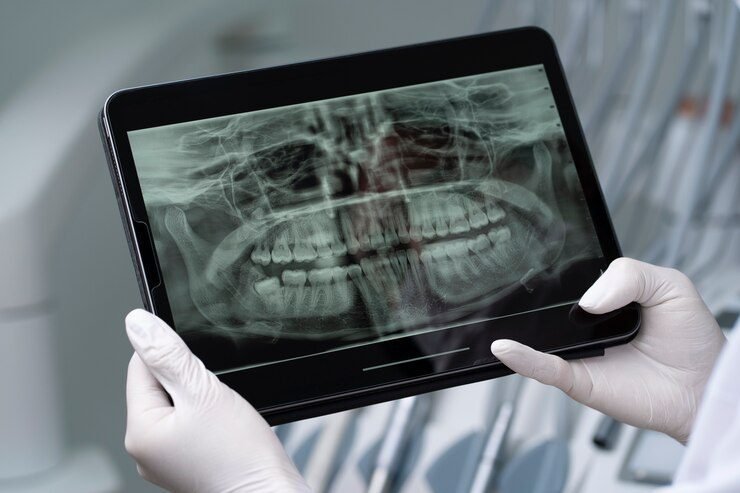 5. How Dental X-rays Aid in Early Detection of Oral Health Issues