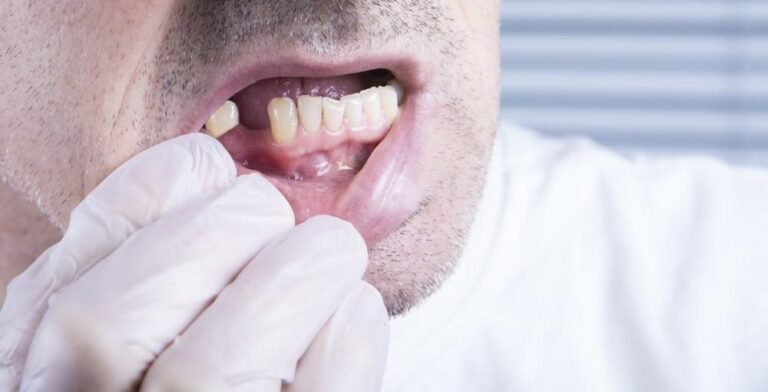 Aging and Oral Health: What You Need to Know and How to Prevent Problems