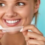 At-Home Teeth Whitening: How It Works and What to Expect