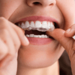 Comparing Invisible Braces to Traditional Braces