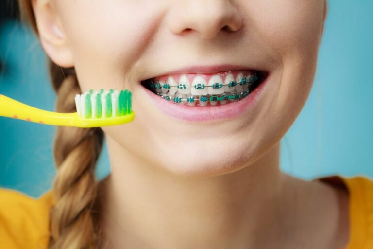 The Impact of Misaligned Teeth on Oral Health