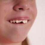 What to Do If Your Child Chips, Cracks, or Knocks Out a Tooth: A Step-by-Step Guide