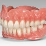 Common Challenges Faced by Denture Wearers and How to Overcome Them