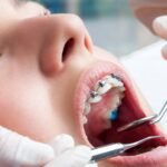 You’re Never Too Old For Braces: The Benefits of Adult Orthodontics