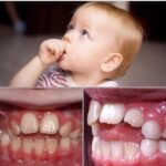 Is Thumb-Sucking Bad for Your Child’s Oral Health?