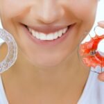 Types of Retainers: How to Choose the Best One for Your Smile