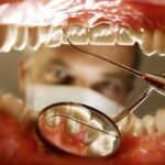 When Should I Go to the Dentist? How Often and Why