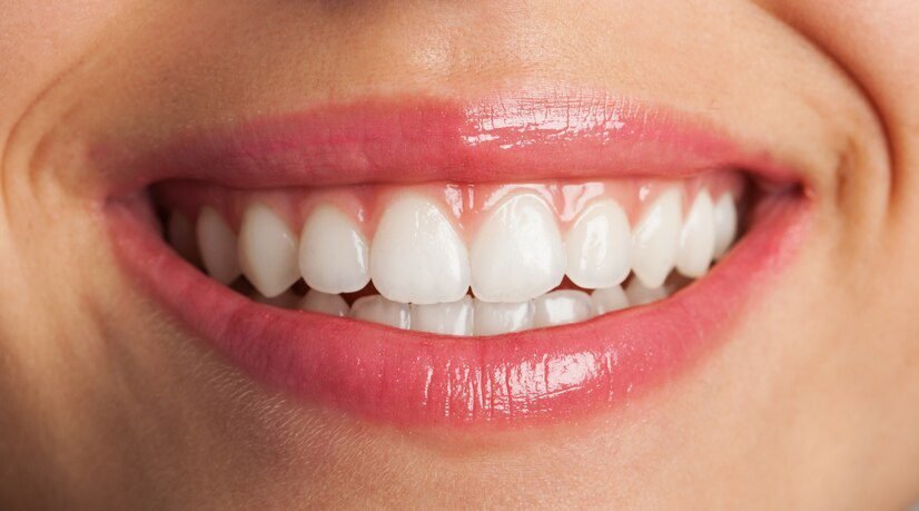 1. Enhances Overall Appearance: Teeth whitening can significantly enhance the overall appearance of your smile, making it brighter and more attractive.