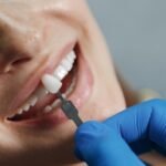 Dental Bridge: Restoring Your Smile and Oral Function