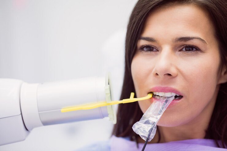 Dental Sealants: Protecting Your Teeth from Decay