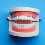 Caring for Dentures: Tips for Keeping Them Clean and Comfortable