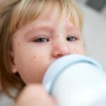 Baby Bottle Syndrome: Protecting Your Child's Teeth from Early Childhood Caries