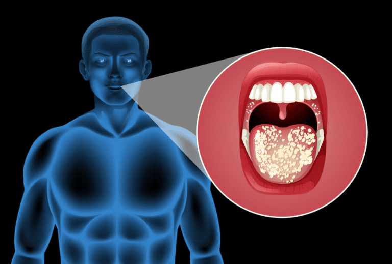 Do You Know the Signs and Symptoms of Oral Cancer? Early Detection and Prevention