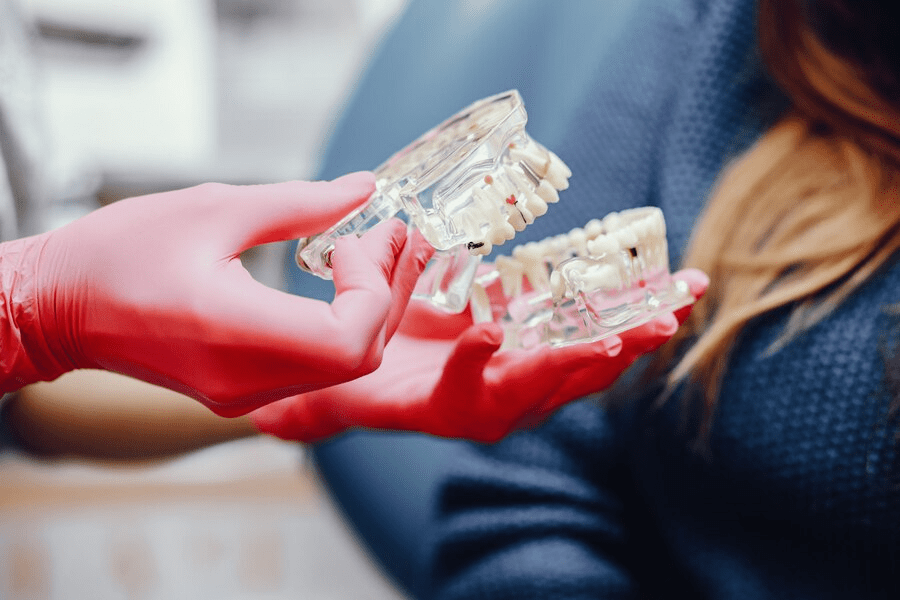 What Are Implant Overdentures? A Stable and Secure Solution for Missing Teeth