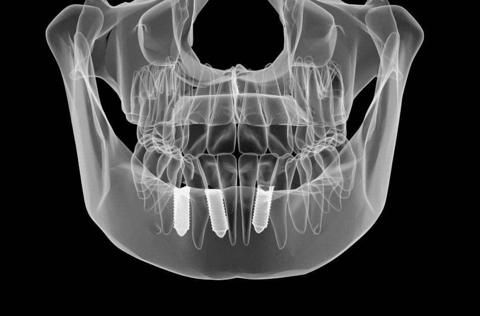 Why You Need Dental X-rays: The Importance of Diagnostic Imaging in Dentistry