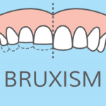 What’s Causing Your Teeth Grinding? Understanding and Managing Bruxism