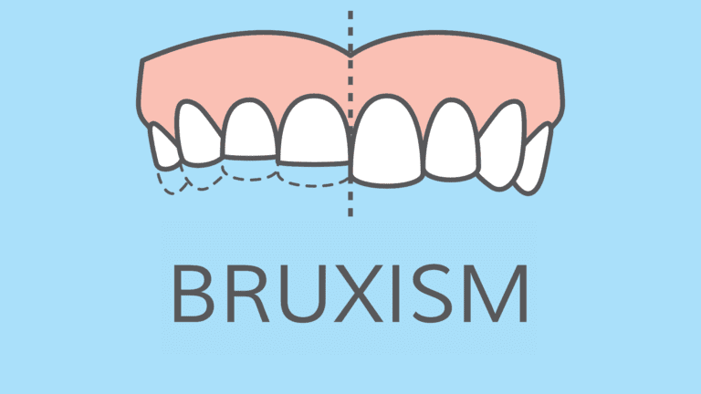 What’s Causing Your Teeth Grinding? Understanding and Managing Bruxism