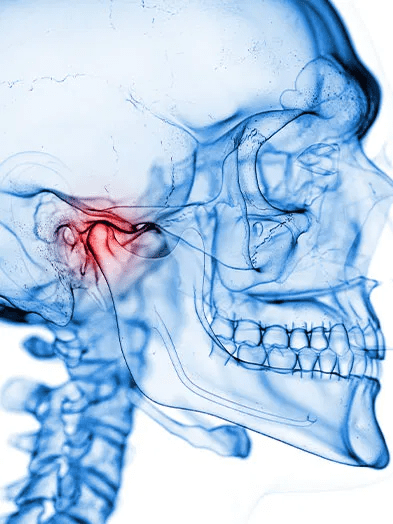 Understanding Temporomandibular Joint Disorder (TMD): Causes, Symptoms, and Treatment Options