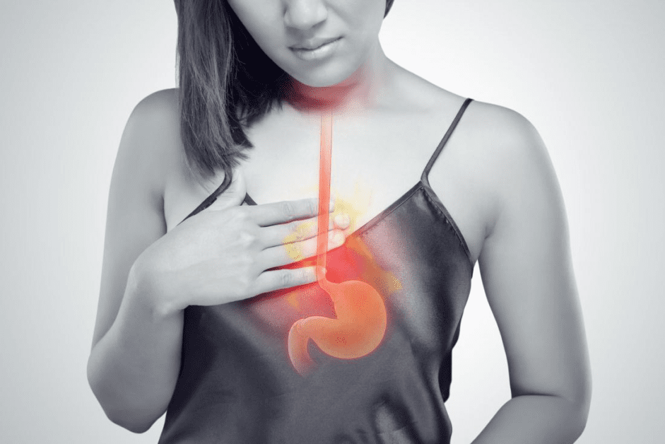 The Impact of Acid Reflux on Oral Health: Prevention and Treatment Strategies