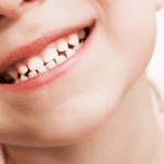 Fillings for Baby Teeth? When and Why They're Necessary