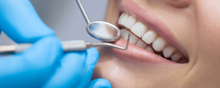 Five Common Ways to Damage Your Teeth: Habits to Avoid for a Healthy Smile