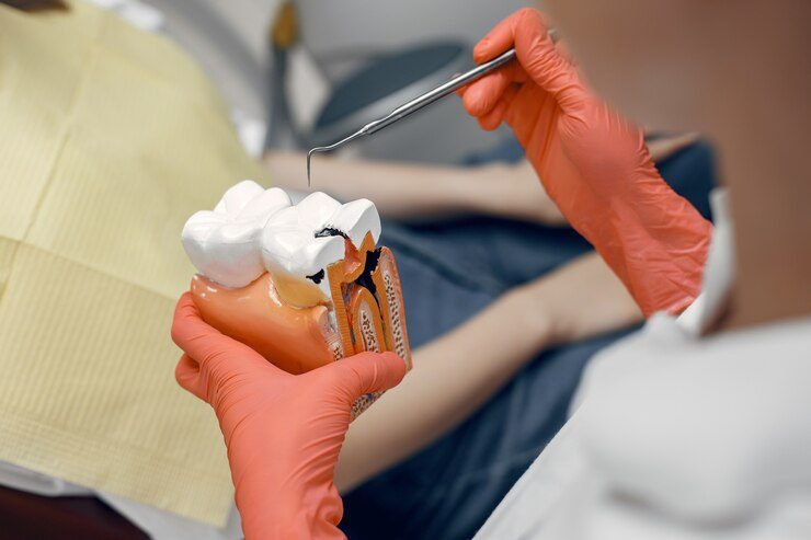 Dental Root Canal: Relieving Pain and Preserving Your Tooth