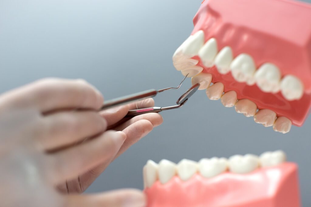 The Advantages of Dental Implants over Traditional Dentures