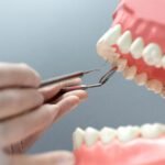 Dental Implants: A Long-Lasting Solution for Missing Teeth