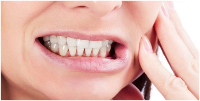 Natural Ways to Stop Teeth Grinding