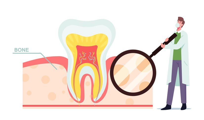 Tooth Decay and Cavities