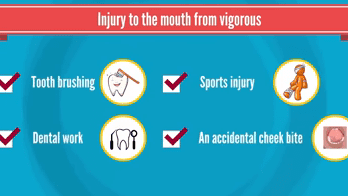 Common Causes of Oral Lesions